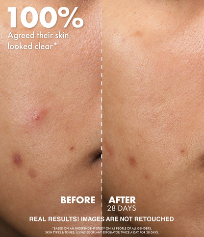 WISHFUL Eggplant Exfoliator: 9.5% AHA, BHA & PHA Pore Clarifying Daily Toner